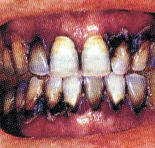 smokers3.jpg